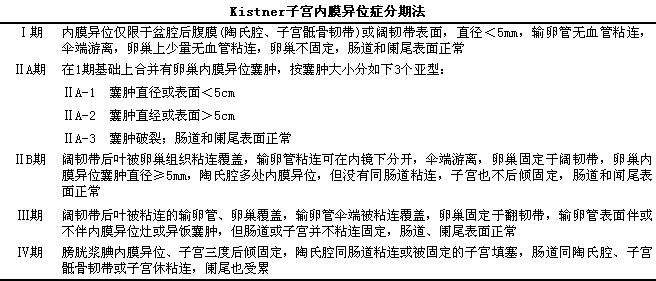 子宫内膜异位症的分期